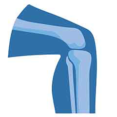 Gelenk-und Knochen gesundheit