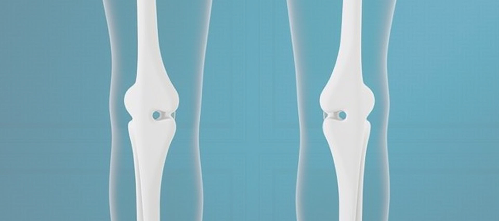 Liposomale Vitamin D3