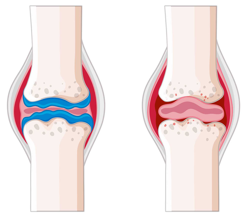 Fördert die Knochen-und Herz-Kreislauf-Gesundheit